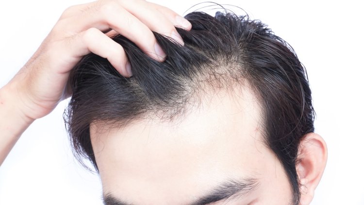 Does The New Growth In Hair Loss Research Help Fight Baldness? – Part 1