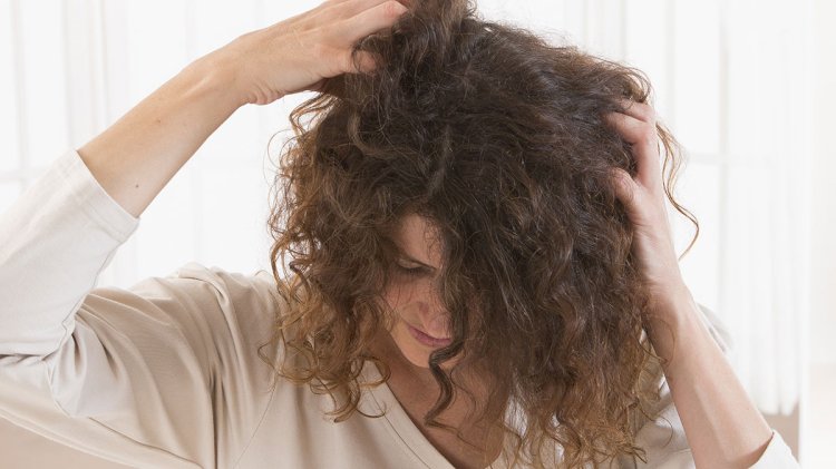 What You Need To Know About Scalp Psoriasis – Part 2