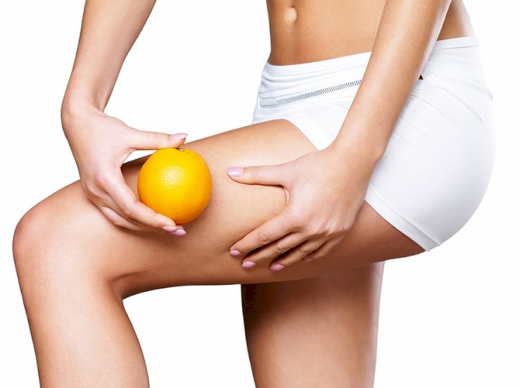 A Detailed Account Of Top Cellulite Fixes And Treatments