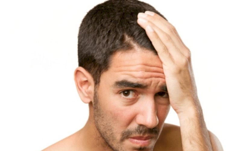 All About Hair Loss When It Is Caused By Hair Shaft Defects – Part 1