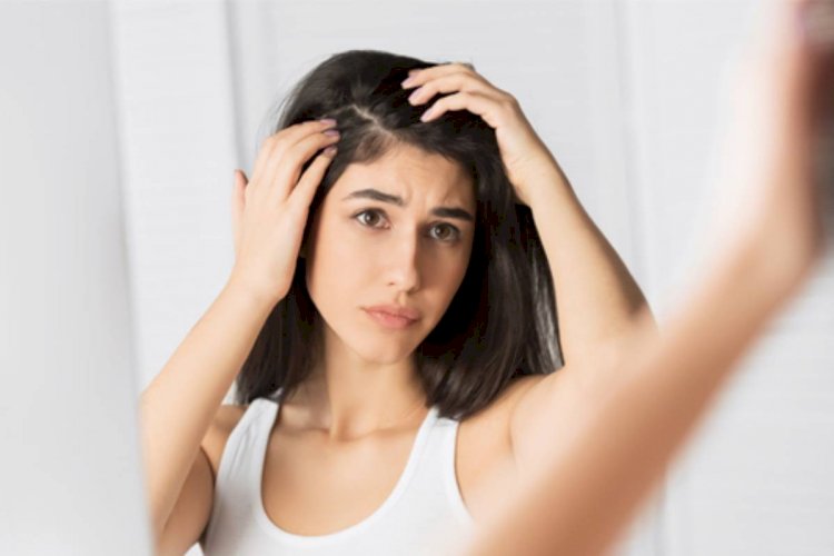 What Are The Surprising Reasons Noted Here For Your Hair Falling Out?
