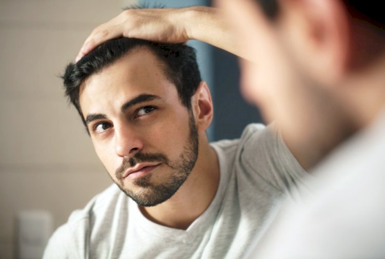 Do You Have A Receding Hairline?