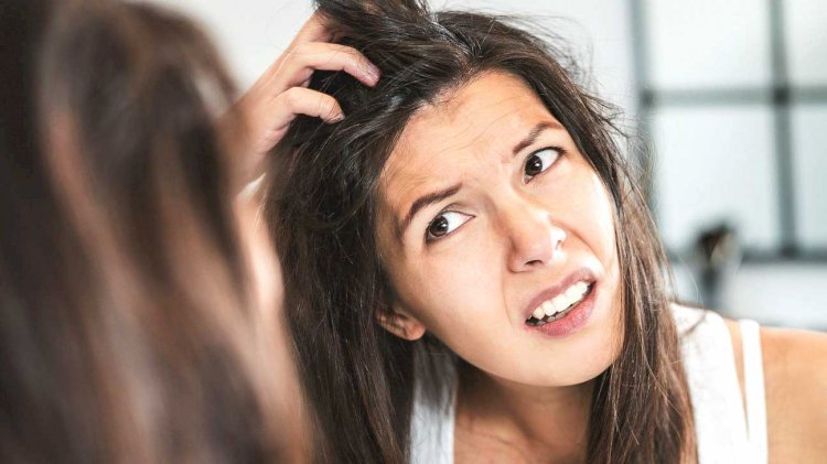 Going Natural For Hair Loss, Dandruff And Hair Problems