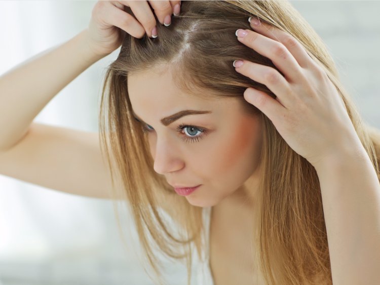 Cover-up Hair Loss With Hair Wigs, Extensions, And Volumisers!