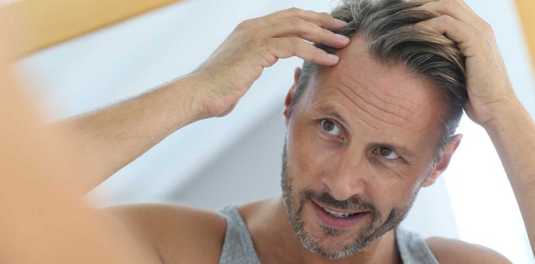 An Overview Of A Hair Transplant & The Male Pattern Baldness