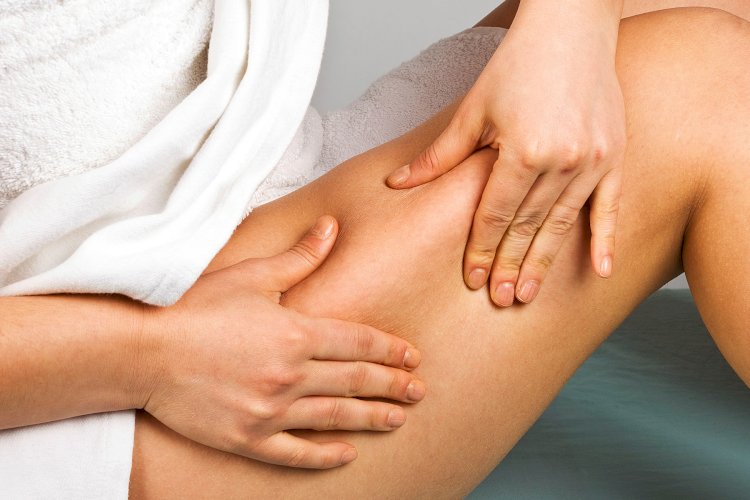 Now, How Do We Fight Cellulite?