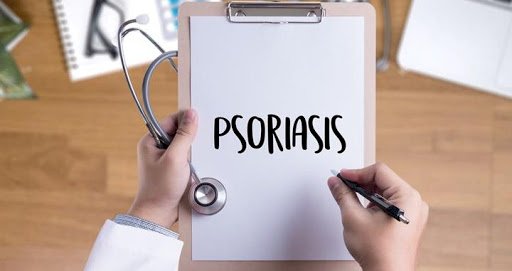 A Report On The Current Cutting Edge Of Psoriasis Research
