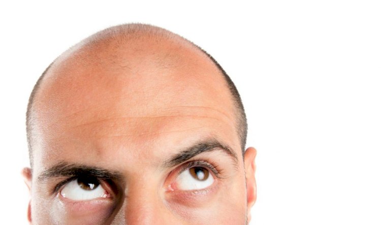 For Hair Loss Treatments, Is There A New Dawn? – Part 1