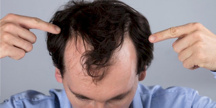 What Lies Ahead As The Future Of Hair Loss Cures?